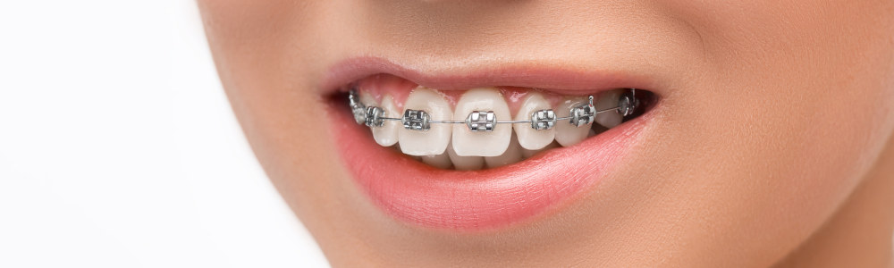 orthodontie paris 9